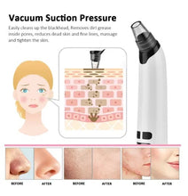 Blackhead Remover Vacuum Suction USB Rechargeable Facial Pore Cleaner Spot Acne Pimple Black Head Deep Extractor Skin Care Kit